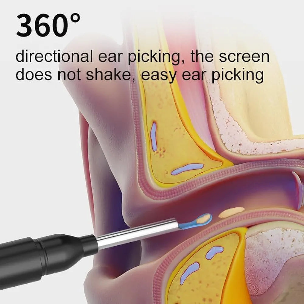 Earocam Earwax Removal Tool Kit with HD Camera WiFi Connection & 6 LED Lights Endoscope Tool Ear Cleaner Set of 8,