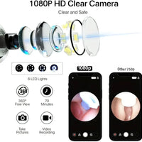 Earocam Earwax Removal Tool Kit with HD Camera WiFi Connection & 6 LED Lights Endoscope Tool Ear Cleaner Set of 8,