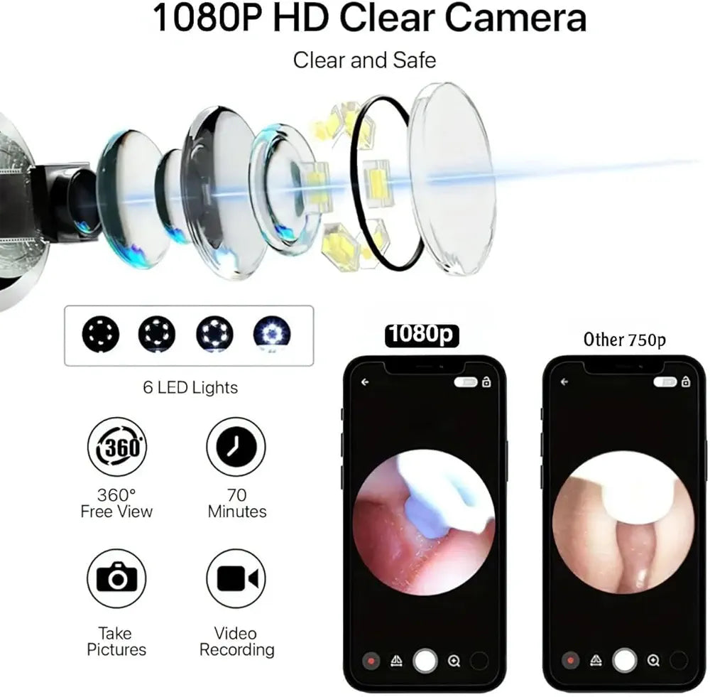 Earocam Earwax Removal Tool Kit with HD Camera WiFi Connection & 6 LED Lights Endoscope Tool Ear Cleaner Set of 8,