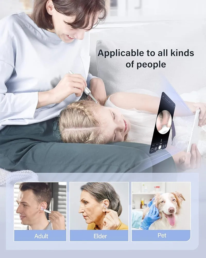Earocam Earwax Removal Tool Kit with HD Camera WiFi Connection & 6 LED Lights Endoscope Tool Ear Cleaner Set of 8,